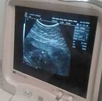 Andres Felipe Monsalve Alzate